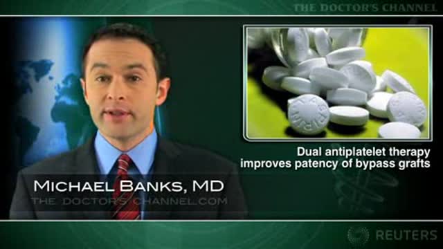 Dual antiplatelet therapy improves early patency of coronary bypass grafts Thumbnail