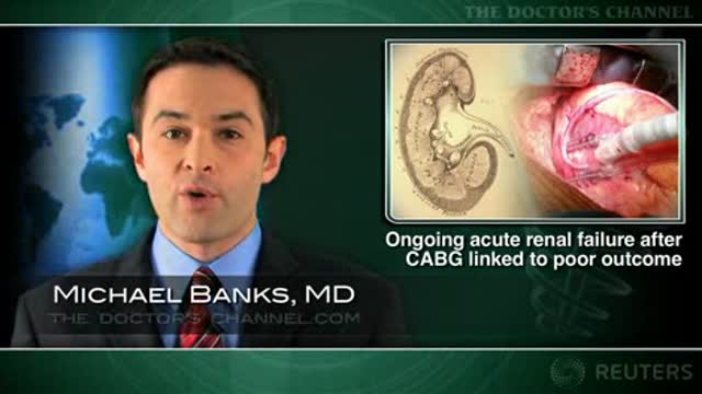 Ongoing acute renal failure after CABG linked to poor outcome Thumbnail