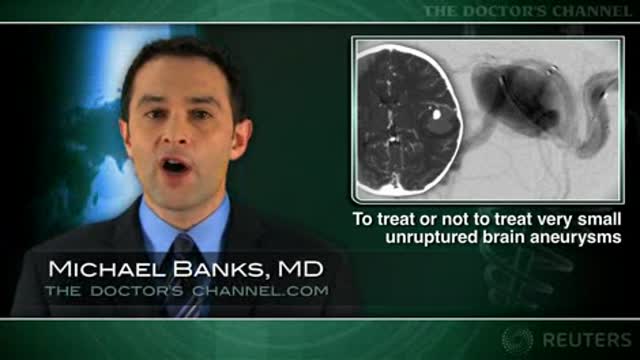 Treatment risks similar for very small or larger unruptured aneurysms Thumbnail
