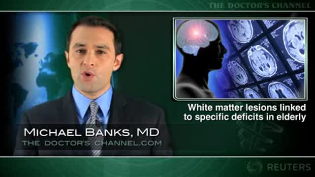 White matter lesions linked to specific motor and cognitive deficits in elderly Thumbnail
