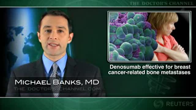 Denosumab effective for breast cancer-related bone metastases Thumbnail