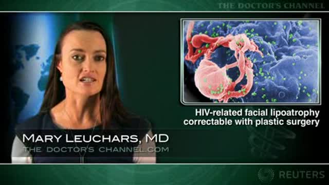 HIV-related facial lipoatrophy can be corrected with plastic surgery Thumbnail