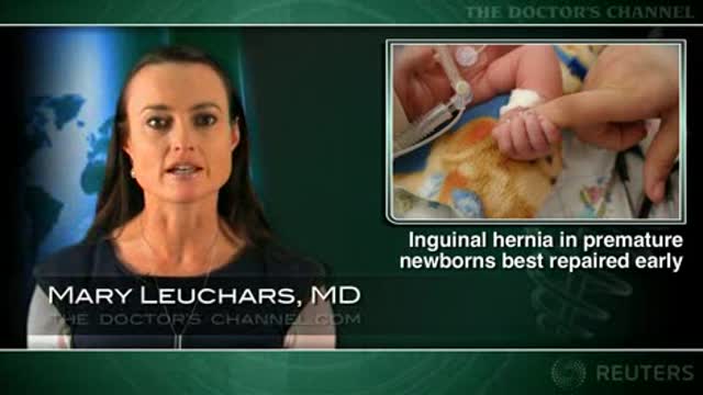 Inguinal hernia in premature newborns best repaired before 40 weeks postconceptual age Thumbnail