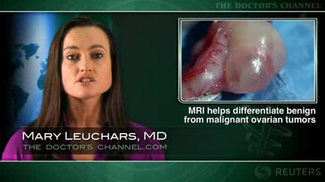 Preop MRI helpful for distinguishing benign from malignant ovarian tumors Thumbnail