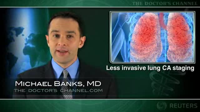 Less invasive lung cancer staging strategy has multiple benefits: study Thumbnail