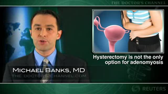 Less invasive options effective for treating adenomyosis Thumbnail