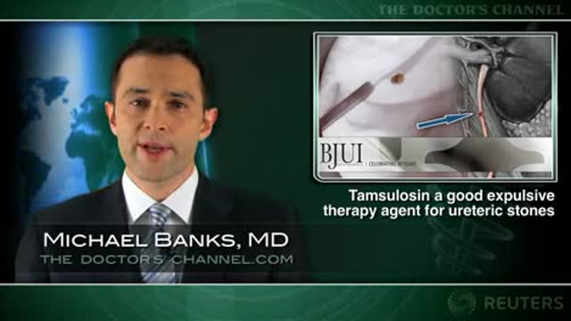 Tamsulosin a good first-line expulsive therapy agent for ureteric stones Thumbnail