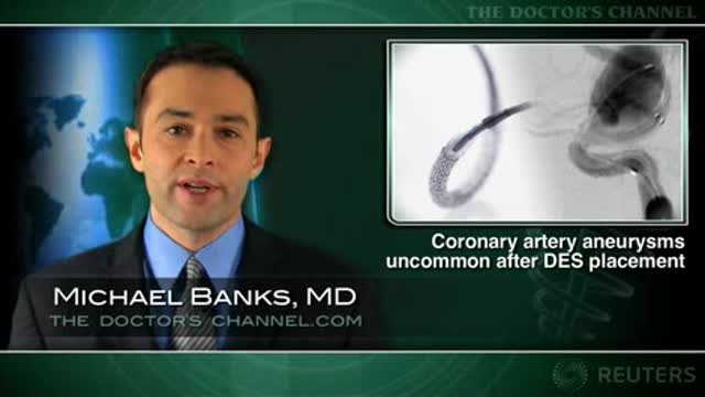 Coronary artery aneurysm uncommon after drug-eluting stent placement Thumbnail