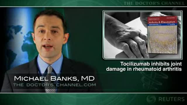 Tocilizumab effective for rheumatoid arthritis when methotrexate insufficient Thumbnail