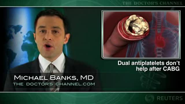 Dual antiplatelets safe, but of little benefit after CABG: study Thumbnail