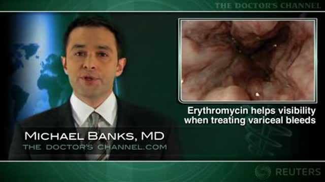 Erythromycin improves visibility during endoscopy for variceal bleeding Thumbnail