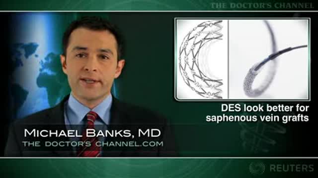 Drug-coated stents work well in saphenous vein graft lesions: meta-analysis Thumbnail
