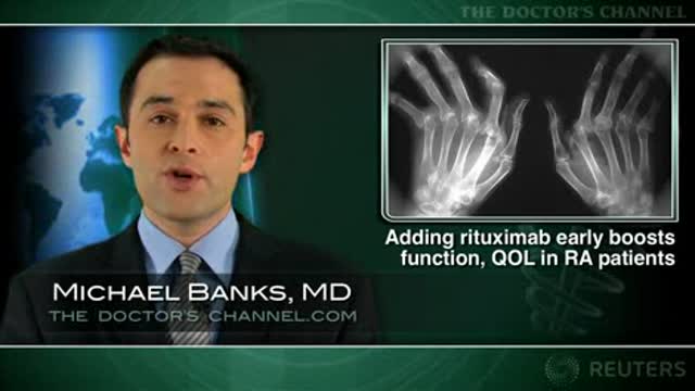 Starting rituximab with methotrexate has benefits in early RA Thumbnail