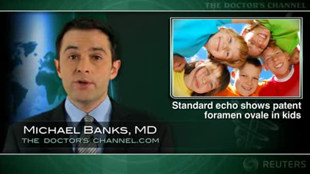 Standard echo finds patent foramen ovale in children: study Thumbnail