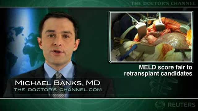 MELD score is fair to patients waiting for liver re-transplant: study Thumbnail