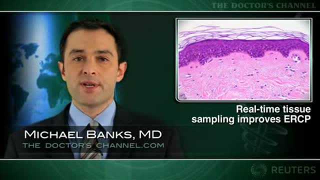 Quick tissue testing aids cholangio­pancreatography yield Thumbnail