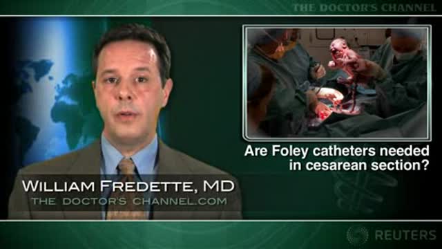 Is an indwelling urinary catheter really needed in cesarean section? Thumbnail