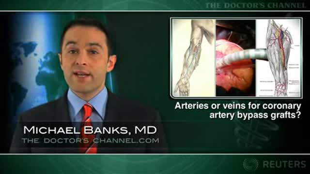 Arterial grafts no better in the short term than veins for CABG Thumbnail