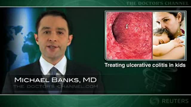 Thiopurine therapy seen effective in about half of pediatric ulcerative colitis cases Thumbnail