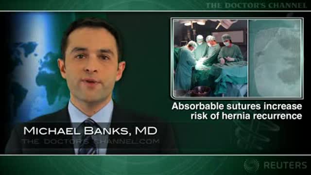 Short-term absorbable sutures not recommended for hernia repair Thumbnail