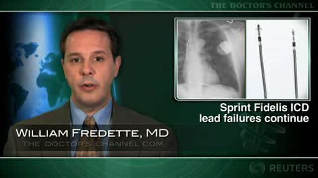 Failure rate of Sprint Fidelis ICD leads impacts patient management Thumbnail