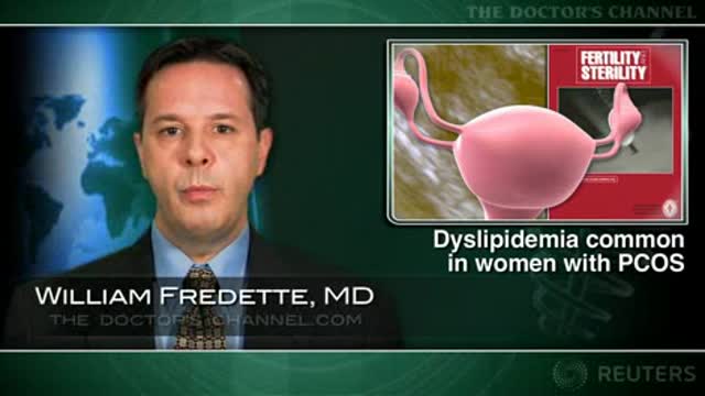 Dyslipidemia common in women with PCOS Thumbnail