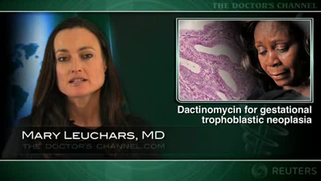 Dactinomycin tops methotrexate for gestational trophoblastic neoplasia Thumbnail