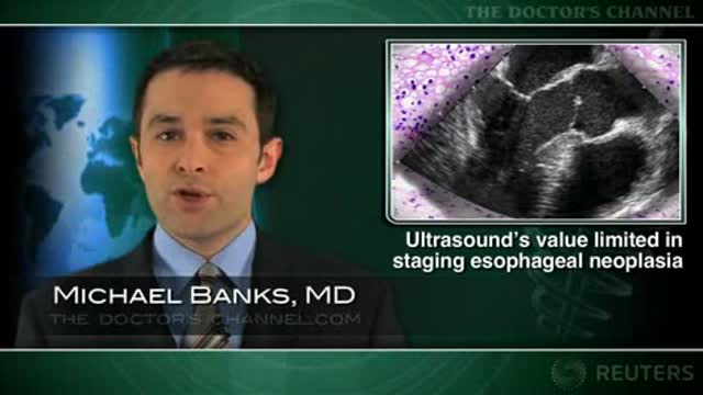 Endoscopic ultrasound questioned in evaluation of early esophageal neoplasia Thumbnail