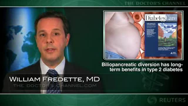 Biliopancreatic diversion has lasting benefits on diabetes complications Thumbnail