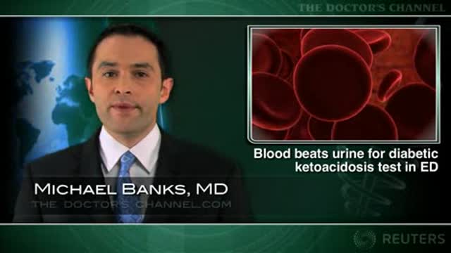Serum ketones better than urine ketones for identifying diabetic ketoacidosis Thumbnail