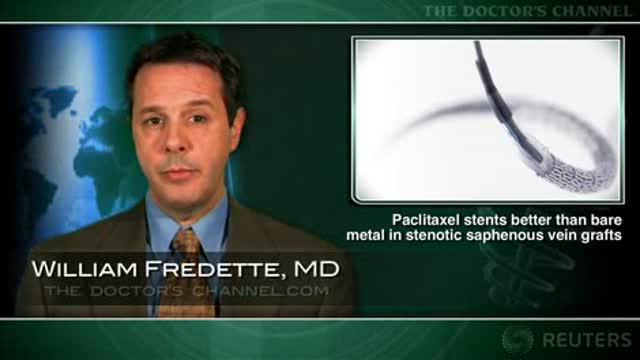 Paclitaxel stents better than bare metal stents for saphenous vein graft lesions Thumbnail
