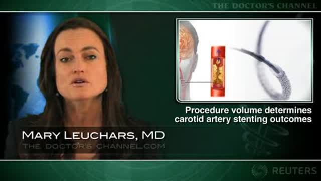Site volume, operator experience linked to carotid artery stenting outcomes Thumbnail