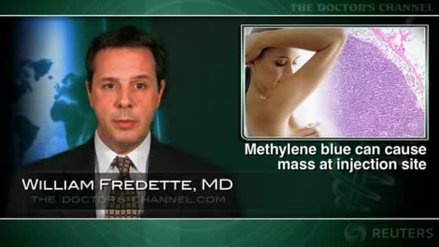 Injection site mass a possibility with methylene blue used for sentinel node mapping Thumbnail