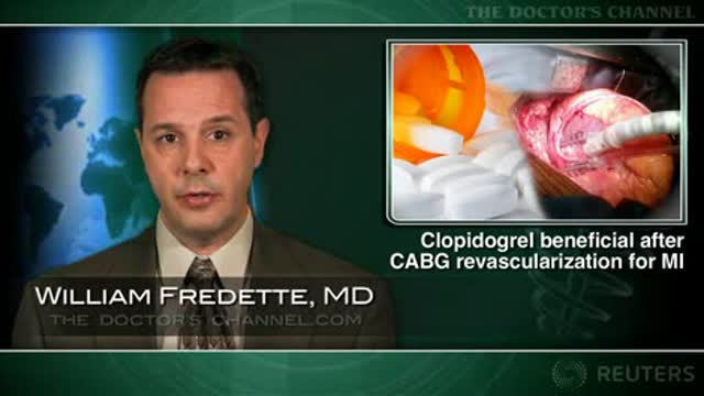 Clopidogrel beneficial after revascularization by CABG following MI Thumbnail
