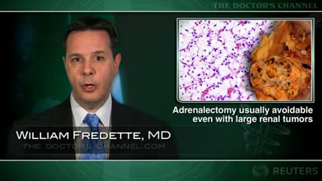 Adrenalectomy usually avoidable even with large renal tumors Thumbnail
