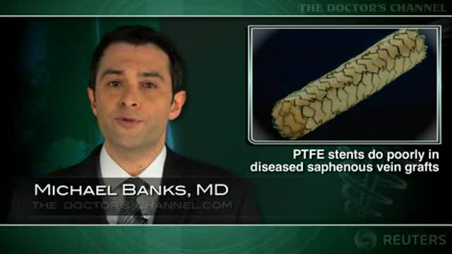 PTFE-covered stents perform poorly in diseased saphenous vein grafts Thumbnail