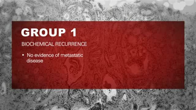 Adjunctive Treatments for Castration Resistant Prostate Cancer Thumbnail