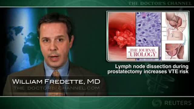 VTE Risk with Pelvic Lymphadenectomy Thumbnail
