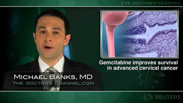 Gemcitabine added to standard therapy improves survival in cervical cancer Thumbnail