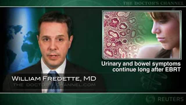 Bowel and bladder trouble linger for years after EBRT for endometrial carcinoma Thumbnail