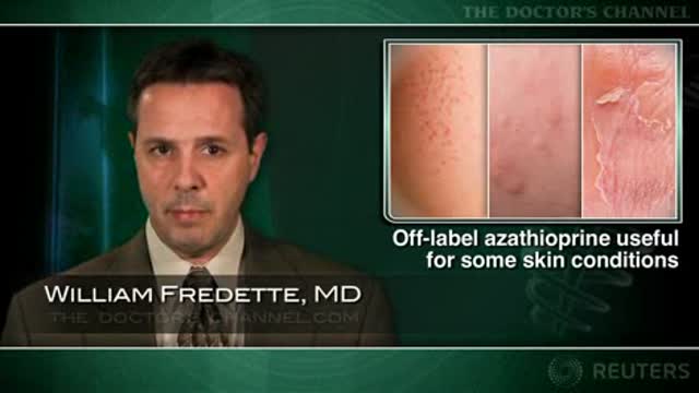 Azathioprine seen useful for some dermatologic conditions Thumbnail