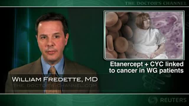 Etanercept + CYC combo may increase cancer risks in Wegener’s Granulomatosis Thumbnail