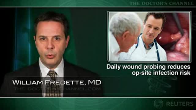 Daily probing of contaminated surgical wounds reduces infection risk Thumbnail