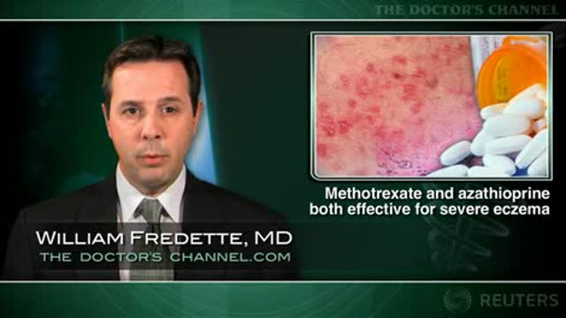 Methotrexate and azathioprine both effective for severe eczema Thumbnail