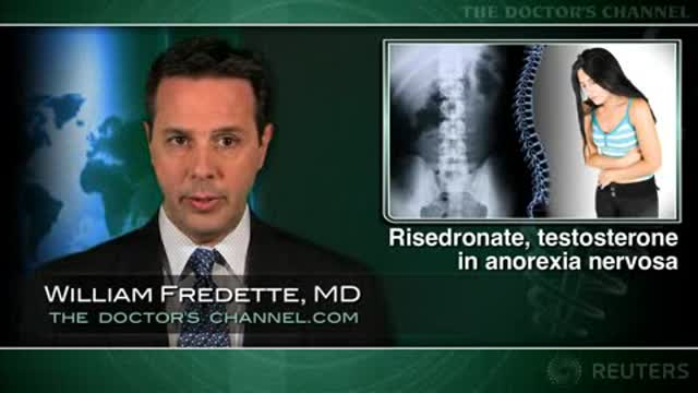 Risedronate and low-dose testosterone seen helpful in anorexia nervosa Thumbnail