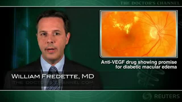 Another anti-VEGF drug showing promise for diabetic macular edema Thumbnail