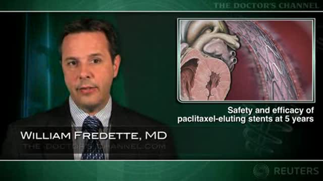 Durable 5-year reduction in re-intervention seen with paclitaxel-eluting stent Thumbnail