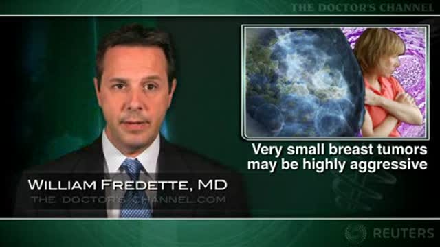 Very small breast tumors may be highly aggressive Thumbnail