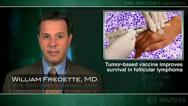 Tumor-derived vaccine improves survival in follicular lymphoma Thumbnail