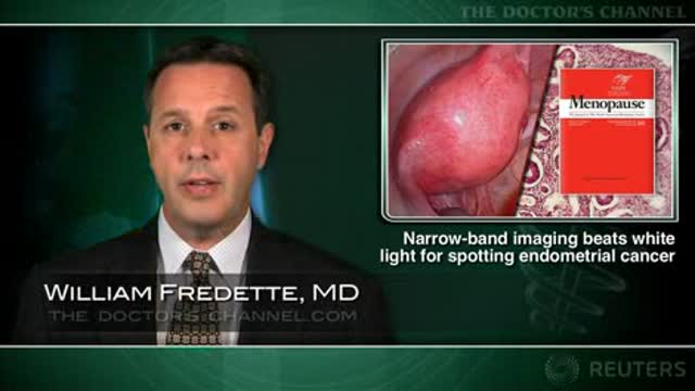 Narrow-band imaging beats white light for spotting endometrial cancer, hyperplasia Thumbnail